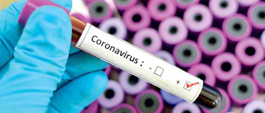 २४ घण्टाको अवधीमा सुदूरपश्चिममा थप ३७ जनामा कोरोना