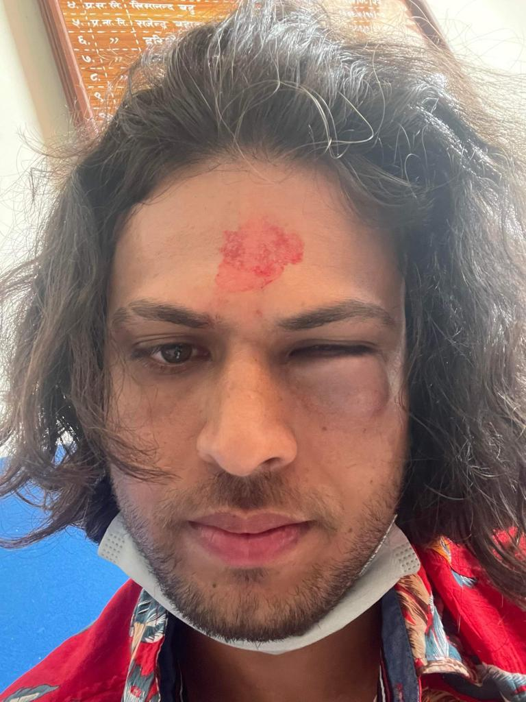 विमानस्थलमा प्रहरीको दादागिरी, यात्रुमाथि कुटपिट