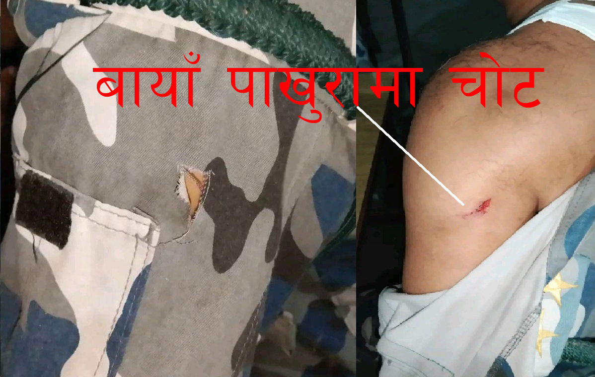 कञ्चनपुरमा सशस्त्रमाथि खुकुरी प्रहारः २ पक्राउ, मुख्य एक फरार